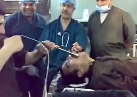 Иракские врачи вытаскивают из мужика гаечный ключ