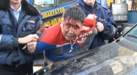 Пьяный водитель разбил голову об свой Мерседес